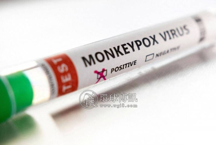 越南尚未发现猴痘病例 但猴痘疫情随时可能爆发