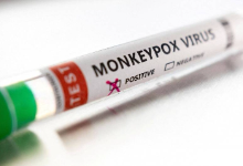 越南尚未发现猴痘病例 但猴痘疫情随时可能爆发