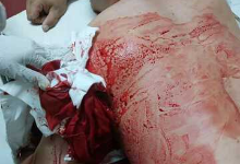 柬埔寨一中国男子将同胞砍成重伤
