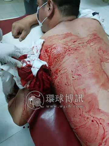 柬埔寨一中国男子将同胞砍成重伤 